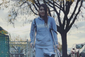 Mizuki Inoue knee 300x200